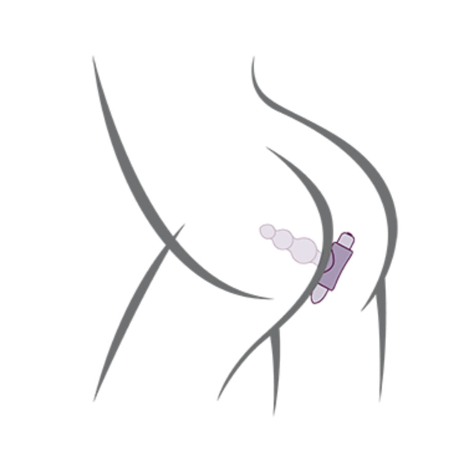 Plug anal Bubbles noir